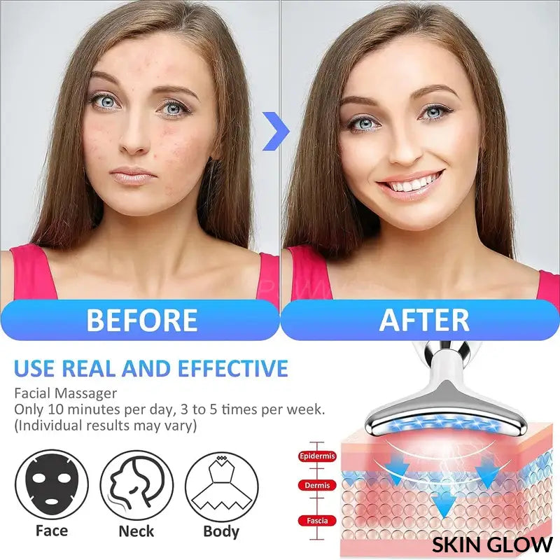 Before and after showing Skin Glow effects with 7 Color Neck Beauty Device EMS Face Lifting Massager