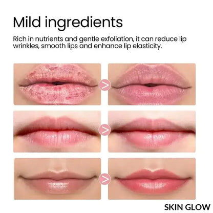 Before and after lip treatments showcasing the effects of Moisturizing Sleeping Lip Mask Night