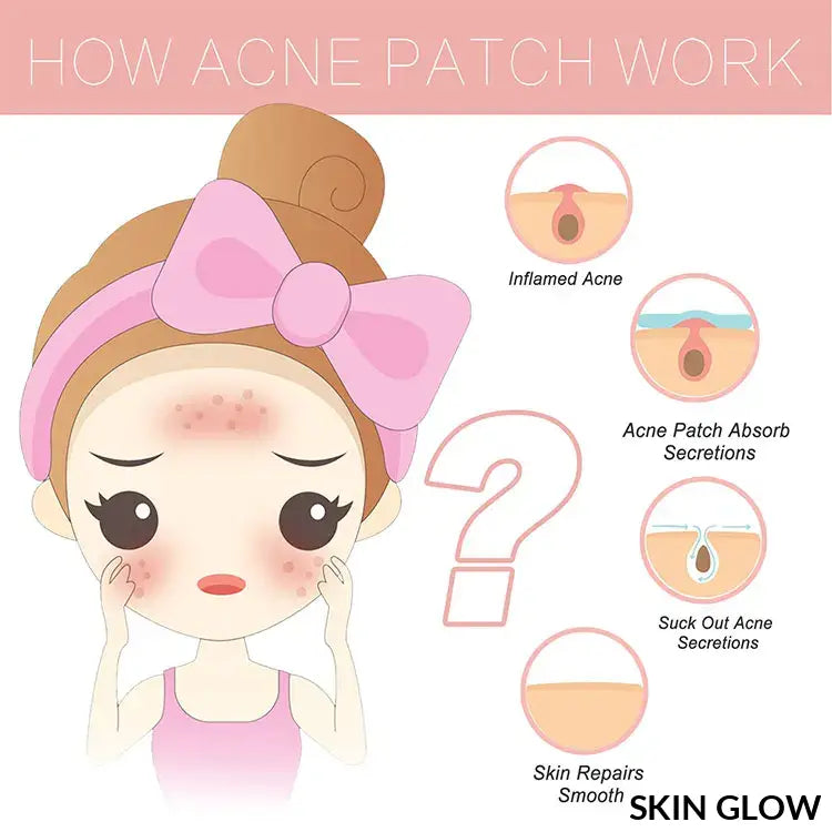 Infographic explaining how the Pimple Patch Invisible works with cute cartoon steps