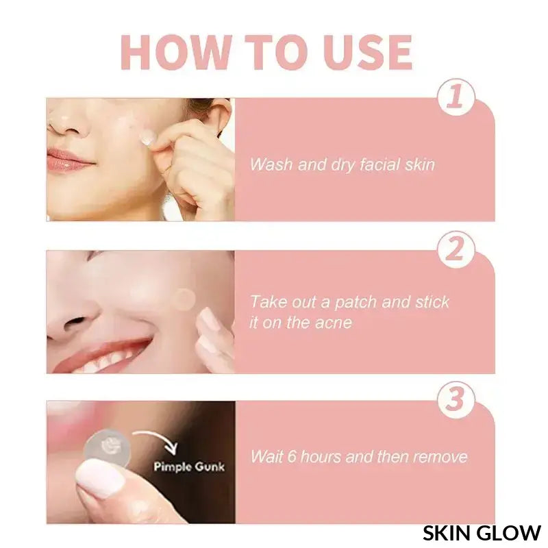 Step-by-step guide for using Pimple Patch Invisible concealer for acne treatment