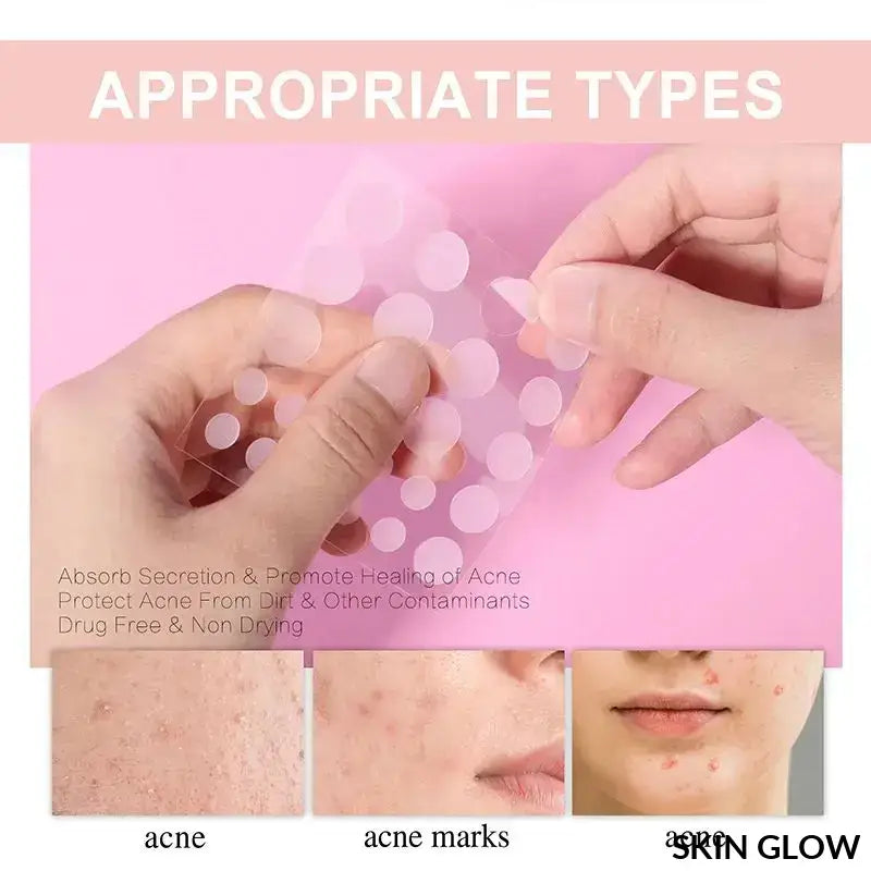 Before and after results of Pimple Patch Invisible Beauty Concealer on a pink background